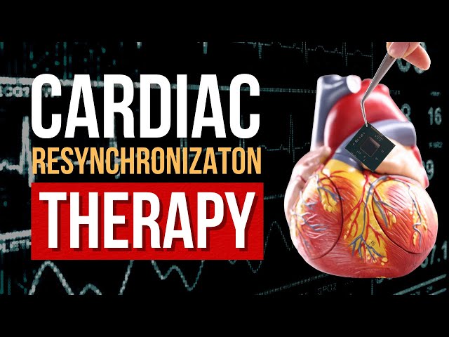 The Power of Cardiac Resynchronization Therapy (CRT) | This Is How CRT Saves Heart!