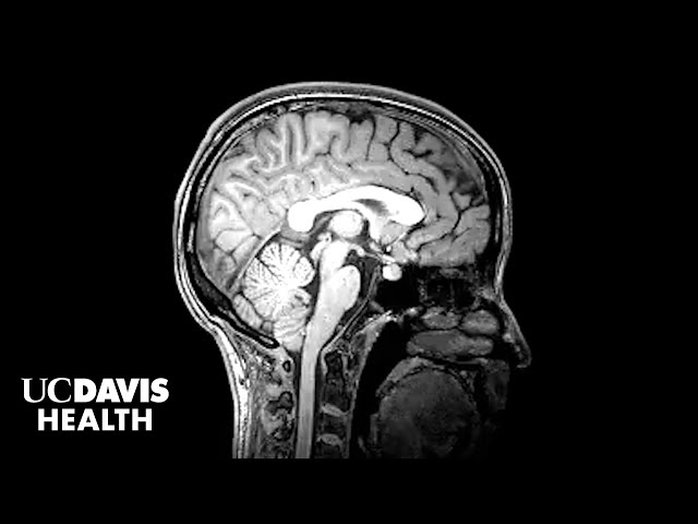 Study Finds Autistic Girls and Boys Show Key Differences in Brain Development |  UC Davis Health
