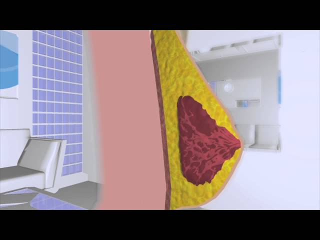 ScienceVisuals/Visualbiotech - "Crisalix 3D Virtual Aesthetics"