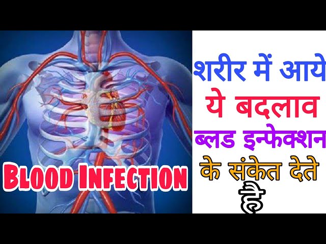 Blood Infection In Hindi - These 10 changes indicate blood infection - Knowledge TV