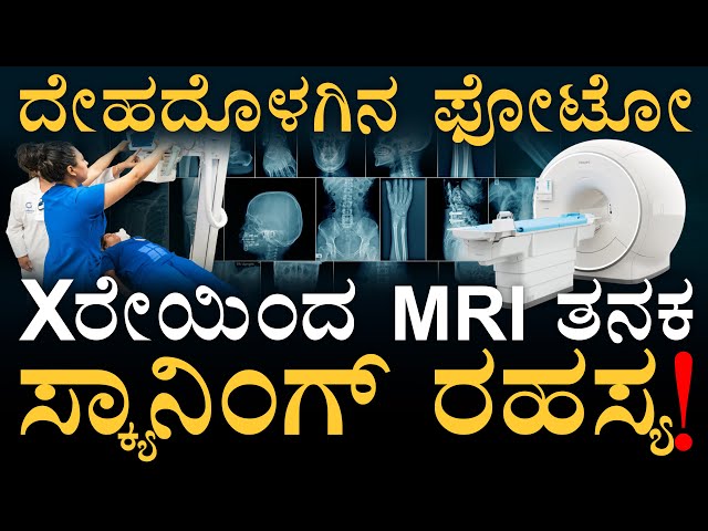 ಸ್ಕ್ಯಾನ್‌ ಮಾಡಿದ್ರೆ ಎಲ್ಲಾ ಗೊತ್ತಗೋದು ನಿಜಾನಾ? | X-ray | CT | MRI | Ultrasound | Masth Magaa | Amar
