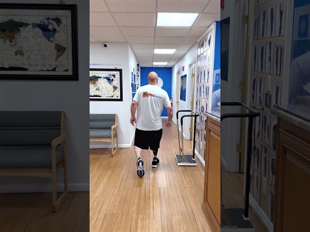 AAbove-Knee Prosthesis Progress | Albert