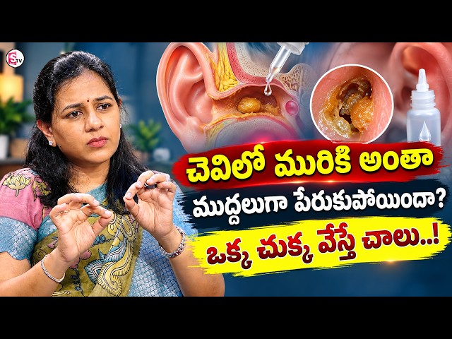 Dr. Harika: Is Earwax Building Up in Lumps? | Know What One Drop Can Do | SumanTV