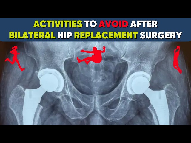 After Bilateral Hip Replacement, What Activities or Movements Should Be Avoided?