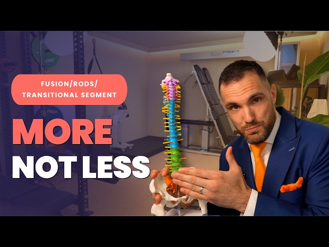 Fusion, Rods Or A Transitional Segment? Why You Need Stability More, Not Less