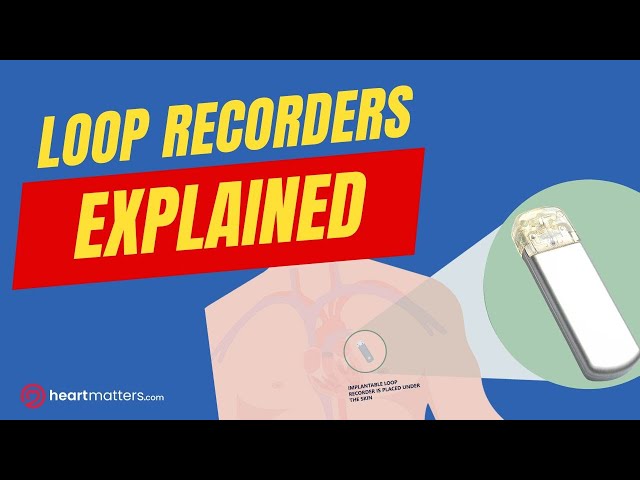 What are Loop Recorders | Implantable Heart Monitors
