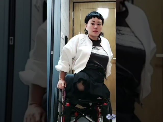Laura DAK amputee showing off her short leg stumps