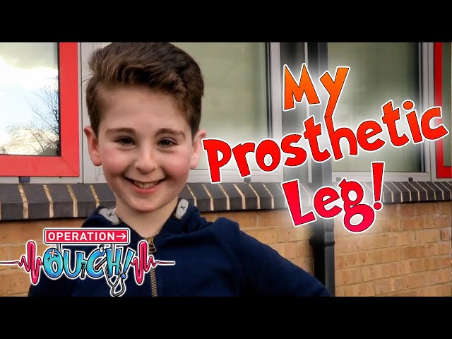 My Prosthetic Leg! 🦿Rio's Story | Science for Kids | Operation Ouch