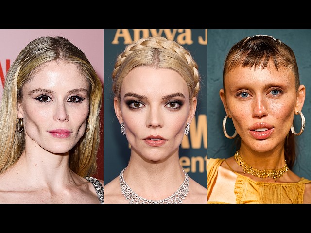 15 Celebrities Whose Buccal Fat Removal Backfired | Before & After Photos 2026