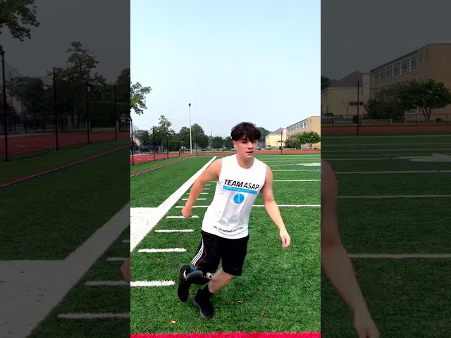 Larry | 15 year old Amputee Receives 1st High Activity Prosthesis