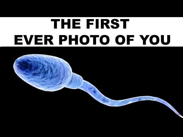 RAREST MEMES