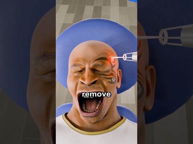 How Tattoos Are Removed ๐ฐ