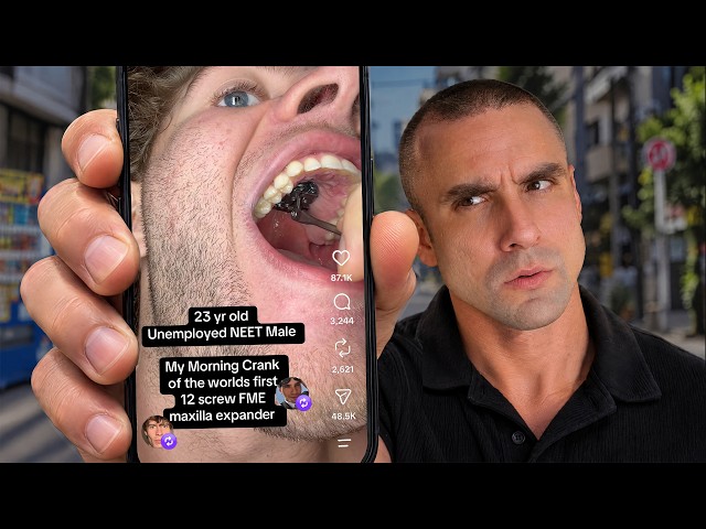 Looksmaxxers are accidentally solving this health epidemic