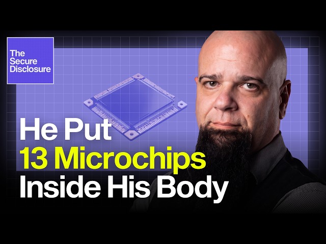 Can You Hack a Human? Transhumanism & Implant Tech Explained | Len Noe