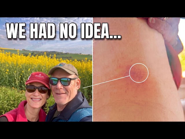Germany’s Hidden Danger: Why You Can’t Ignore Ticks