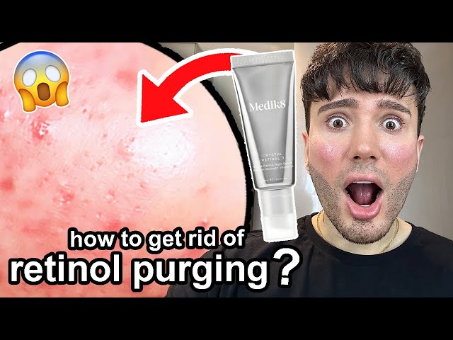 HOW TO REDUCE RETINOL PURGING!😱