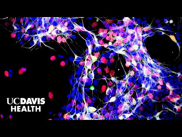 Exploring Stem Cell Treatments for Glaucoma-Related Blindness | UC Davis Health Research