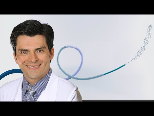 Trackability and tip durability of new CEREGLIDE 71 Intermediate Catheter with TruCourse technology