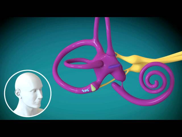 MUSC: Benign Paroxysmal Positional Vertigo (BPPV)