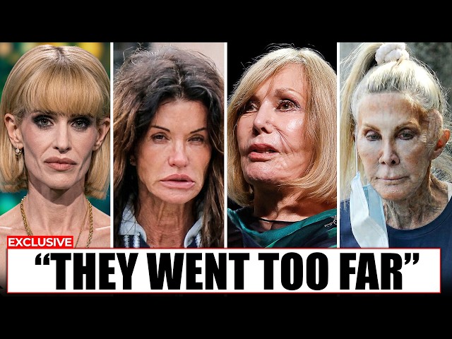 Celebrities Who Went Too Far With Plastic Surgery (Unrecognizable in 2026)