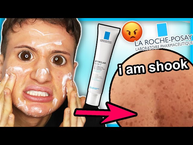 I tried La Roche Posay EFFACLAR DUO for ONE WEEK!! (dark spots are... still here?!)
