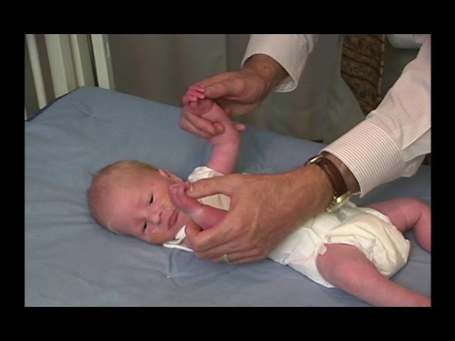 Pediatric Neurologic Exam: Abnormal Newborn