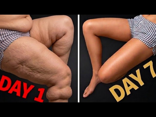 Lose Inner Thigh Fat Fast at Home (No Equipment Workout)