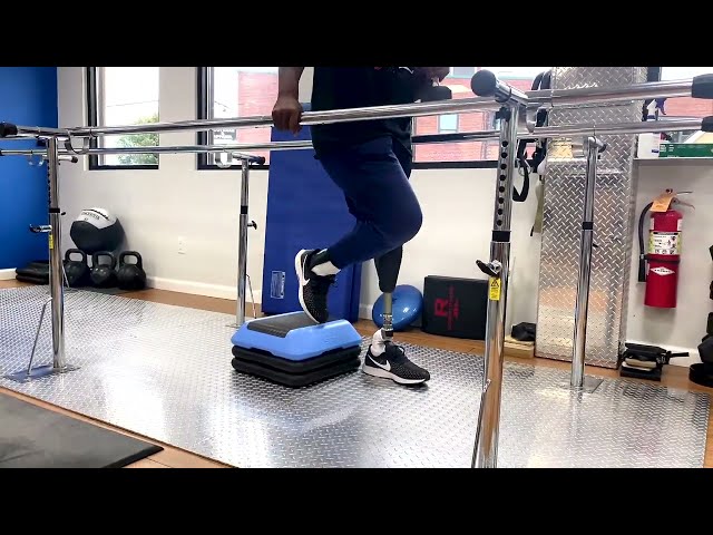 Hip Disarticulation Amputee beating the odds!