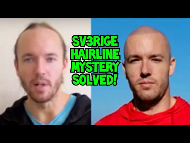 Sv3rige Gets Tattoo Hairline Instead of Seeing His Son
