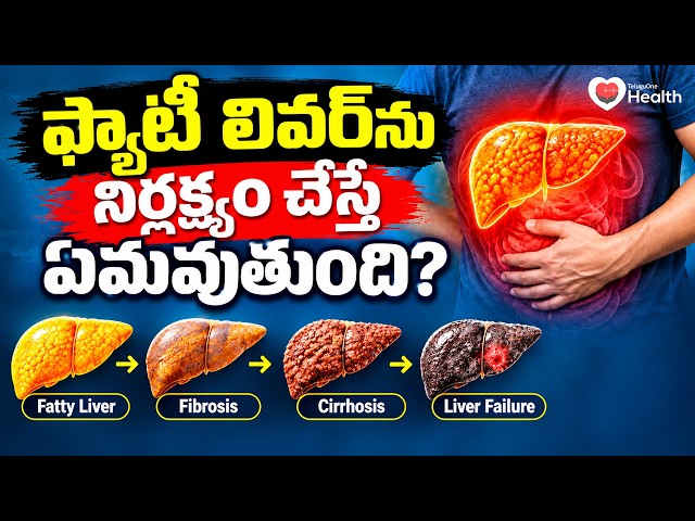 Liver Health | ఫ్యాటీ లివర్‌ను నిర్లక్ష్యం చేస్తే ఏమవుతుంది? | Dr Krishna gopal | TeluguOneHealth
