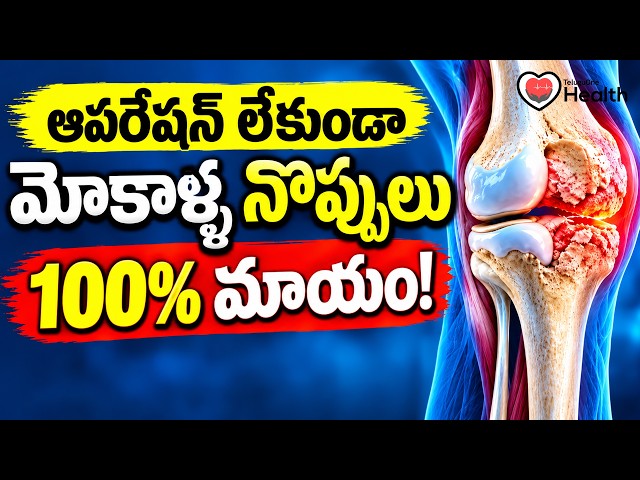 ఆపరేషన్ లేకుండా మోకాళ్ళ నొప్పులు 100% మాయం!| Knee Pain Treatment| Dr. Venkat Jajula| TeluguOneHealth