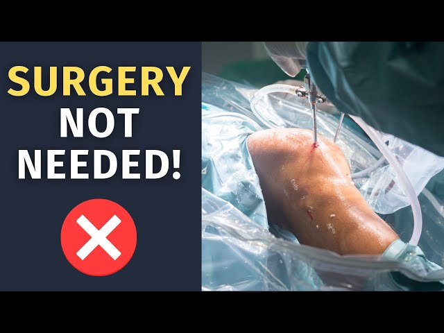 Treat Meniscus Injury Without Surgery