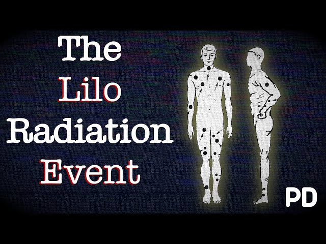 The 1997 Lilo Orphaned Source Radiation Incident 1997 | Short Documentary | Plainly Difficult