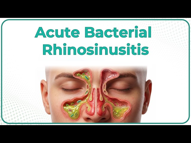 Acute Bacterial Rhinosinusitis 👃 (ABRS) : ENT Lectures