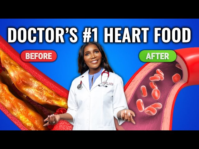 Top 5 Foods To Prevent Stroke and Heart Attacks - Clear Arteries FAST!