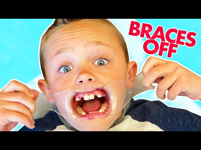 Top Kade Skye Videos (Love Potion, Braces Off) | Fun Squad