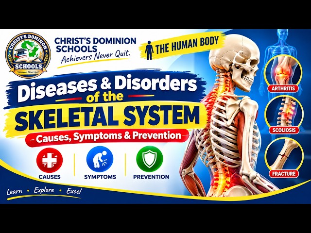 DESEASES & DISORDERS OF THE  SKELETAL SYSTEM | CAUSES, SYMPTOMS & PREVETIOND