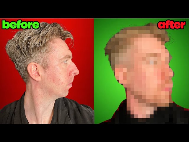 Lewis Spears Face Reveal