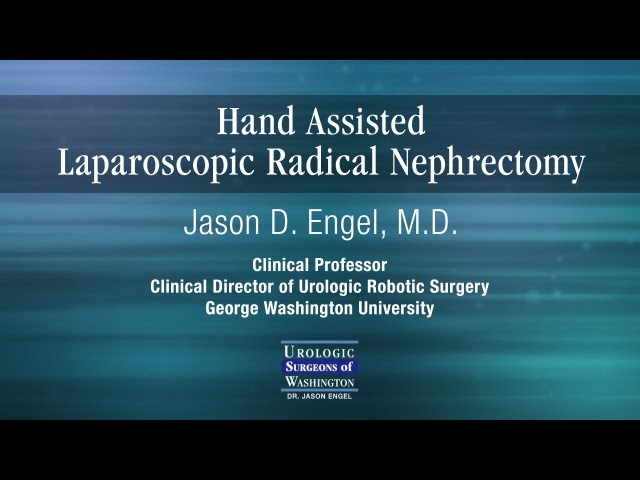 Hand Assisted Radical Nephrectomy