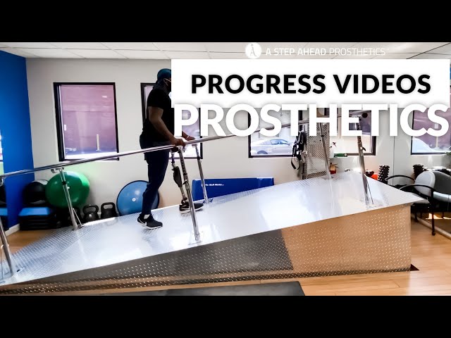 First time using a prosthetic since becoming an amputee