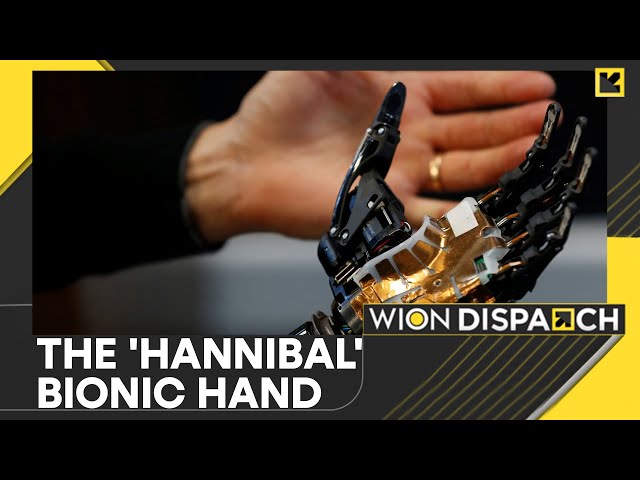 AI Bionic Limb, Ready To Be Used In Just One Week | New Era For Prosthetics | WION