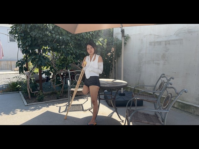 Abby Ooe, the Amputee Girl – Bandaged Amputated Limb #bandage #disability #disabled