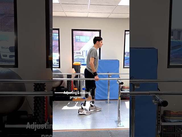 Azis’ First Steps with Prosthetics After Losing Both Legs in a Car Accident