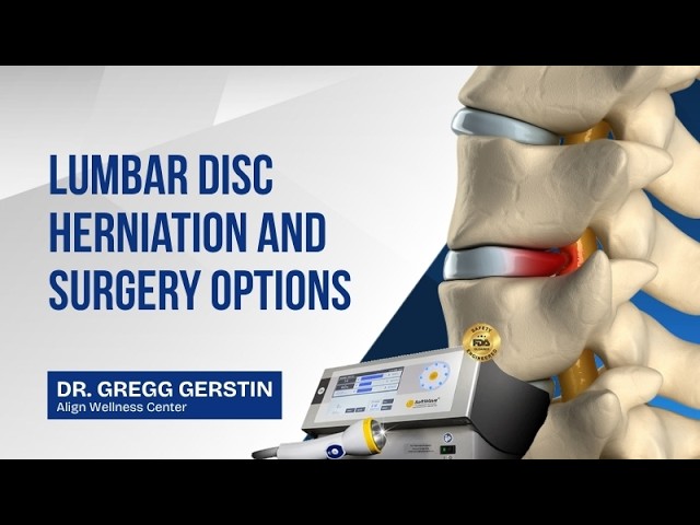Lumbar Disc Herniation and Surgery Options