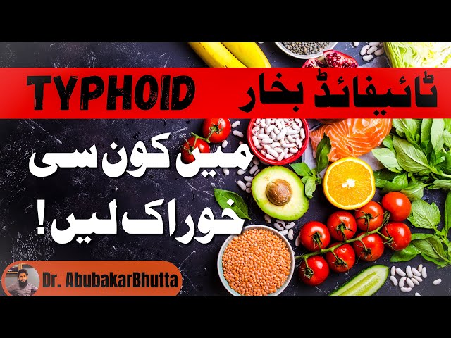 Typhoid Fever Diet Plan | What to eat during Typhoid Fever