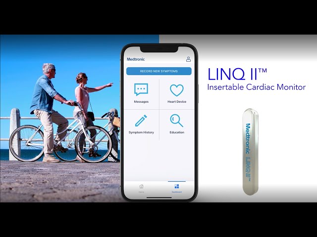 Living with the LINQ II™ ICM