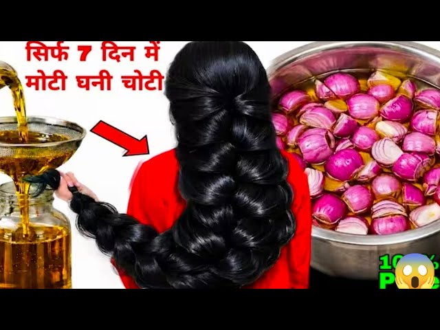 Home Made Onion Hair Growth Oil for Extreme Hair Growth/How To Make Onion Hair Growth Oil At Home 