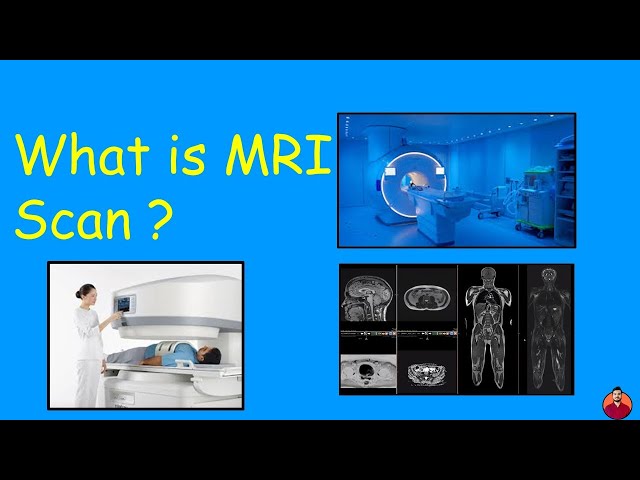 What is an MRI Scan?