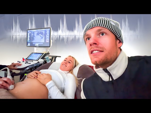 VOOR HET EERST NAAR DE HARTSLAG LUISTEREN!👶🏼 | baby vlog #3