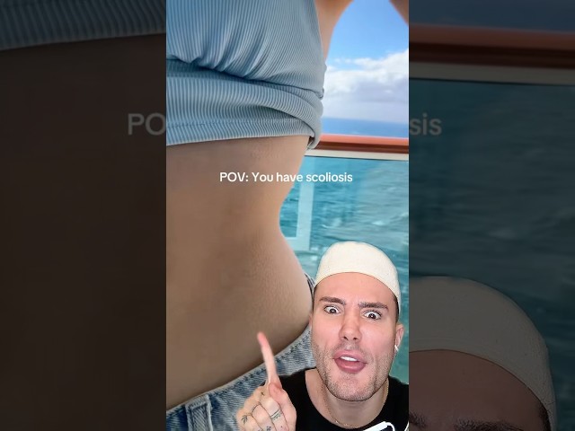 POV: you have scoliosis!😱 #beautytips #beautyhacks #beautyshorts